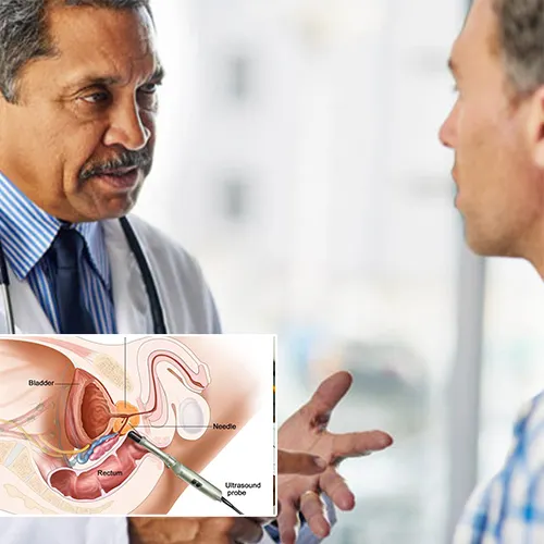 Understanding Your Investment in Penile Implant Surgery