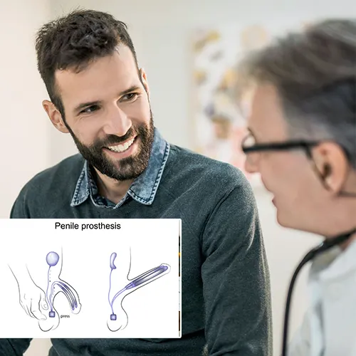 Welcome to   High Pointe Surgery Center

: Your Guide to Daily Care for Penile Implants